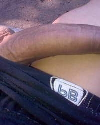 photo-thumb