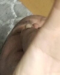 photo-thumb