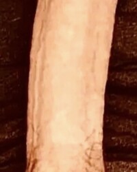 photo-thumb