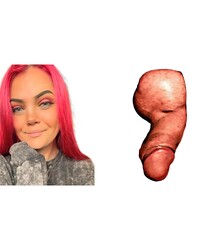 photo-thumb