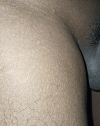 photo-thumb