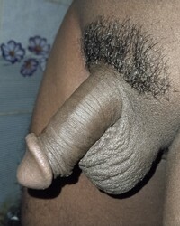 photo-thumb