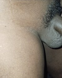photo-thumb