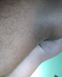 photo-thumb