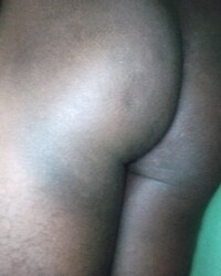 photo-thumb