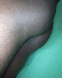 photo-thumb