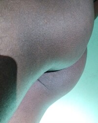 photo-thumb