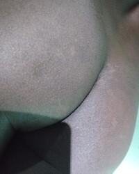 photo-thumb