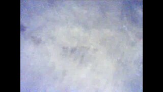 Thumb 9