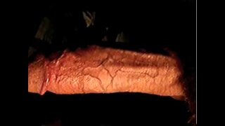 Thumb 6