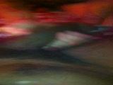 Thumb 9