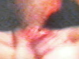 Thumb 7