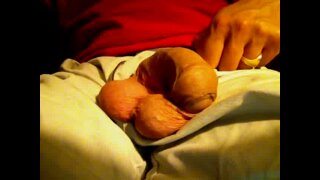 Thumb 3