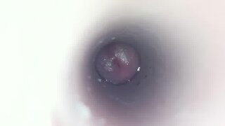 Thumb 6