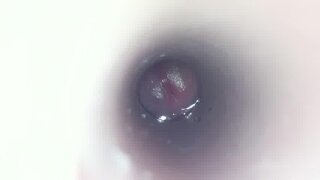 Thumb 7