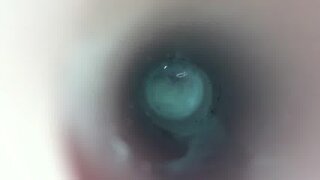 Thumb 9