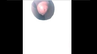 Thumb 10