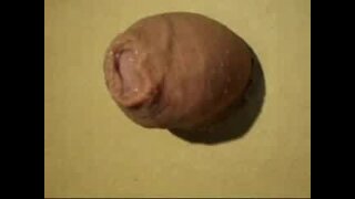 Thumb 9