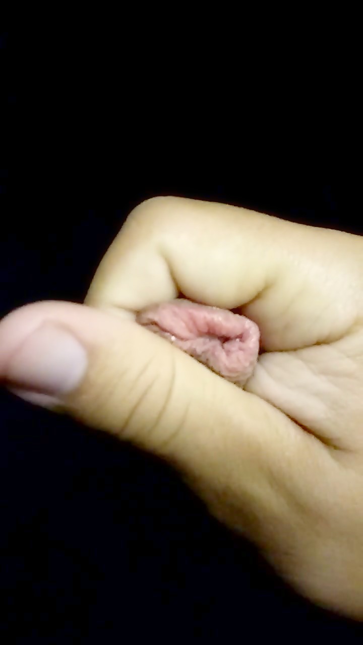 Thumb 1
