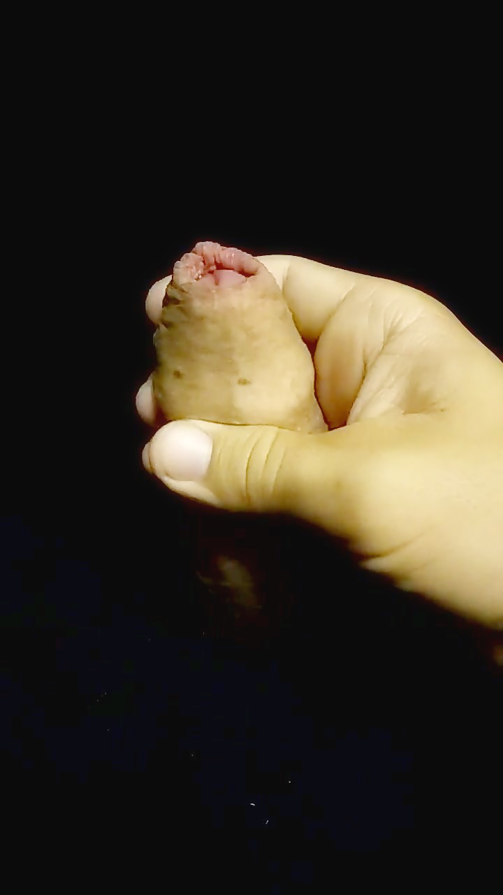 Thumb 15