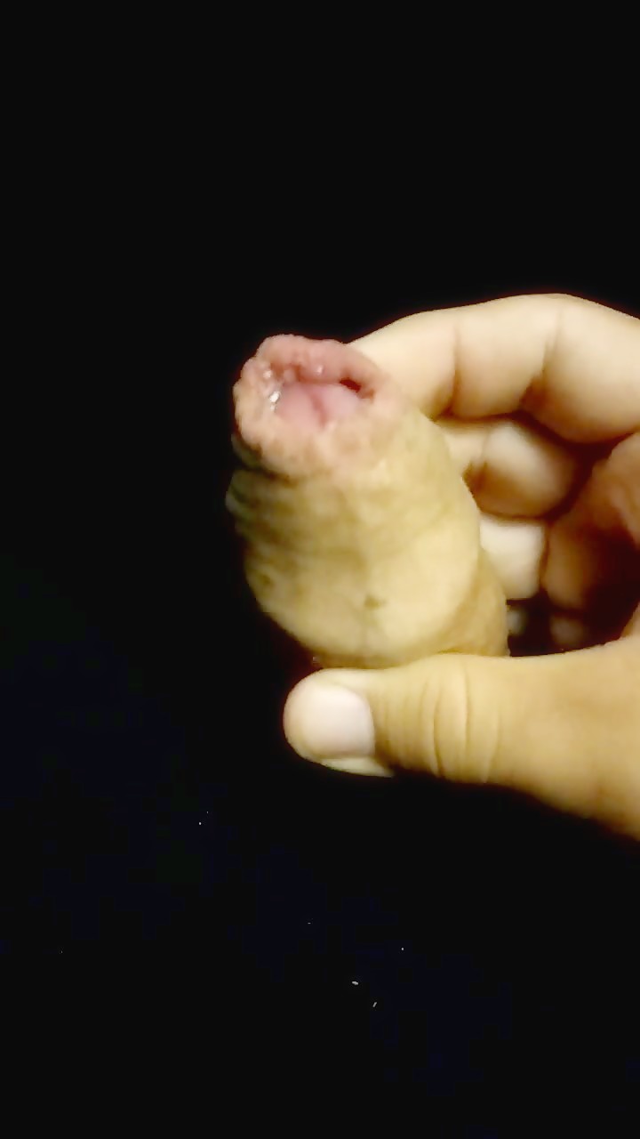 Thumb 8