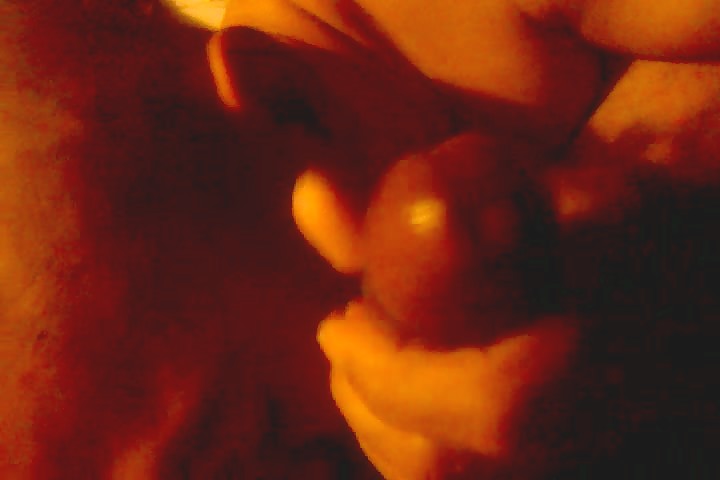 Thumb 17