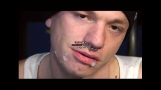 Thumb 10