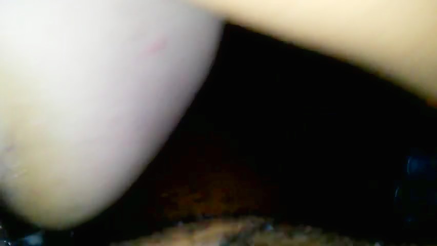 Thumb 13