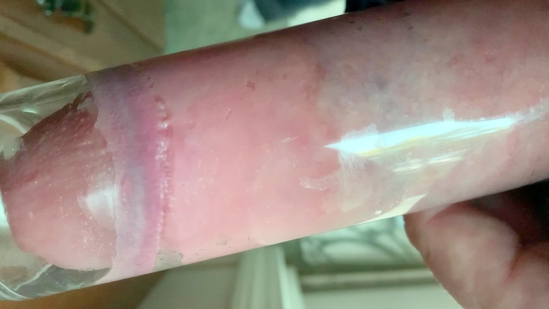 Thumb 13