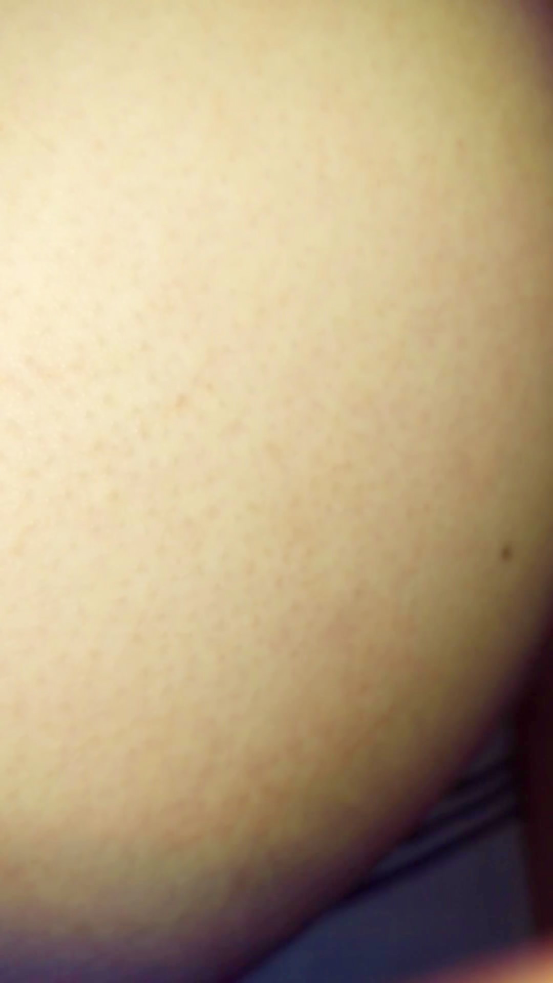 Thumb 20