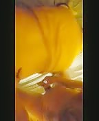 Thumb 17