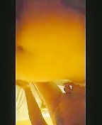 Thumb 7