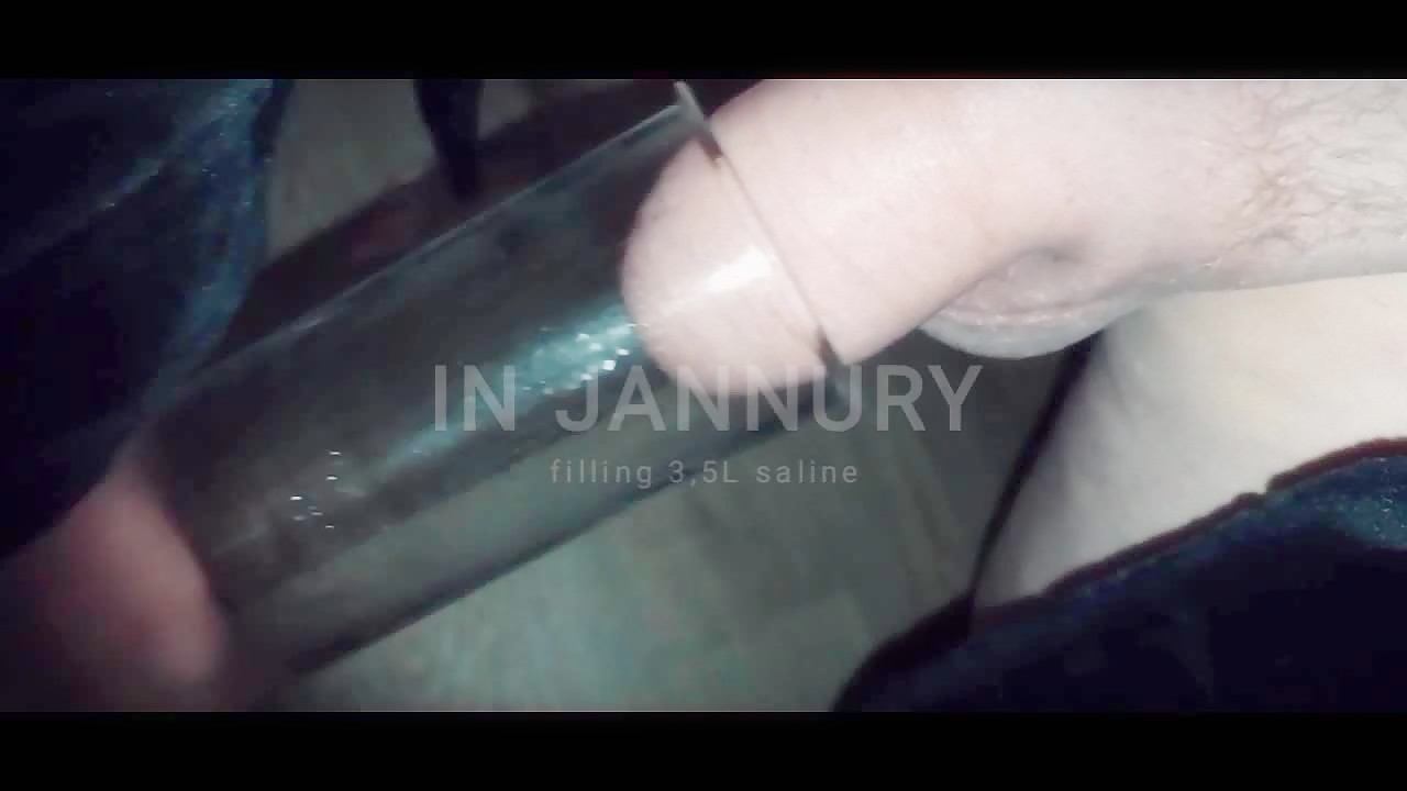 Thumb 17