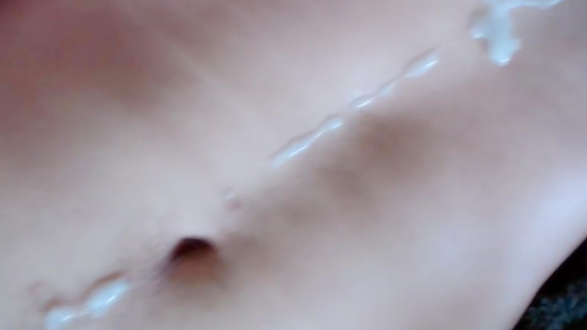 Thumb 20