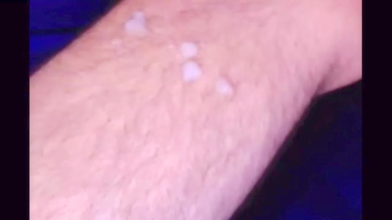 Thumb 20