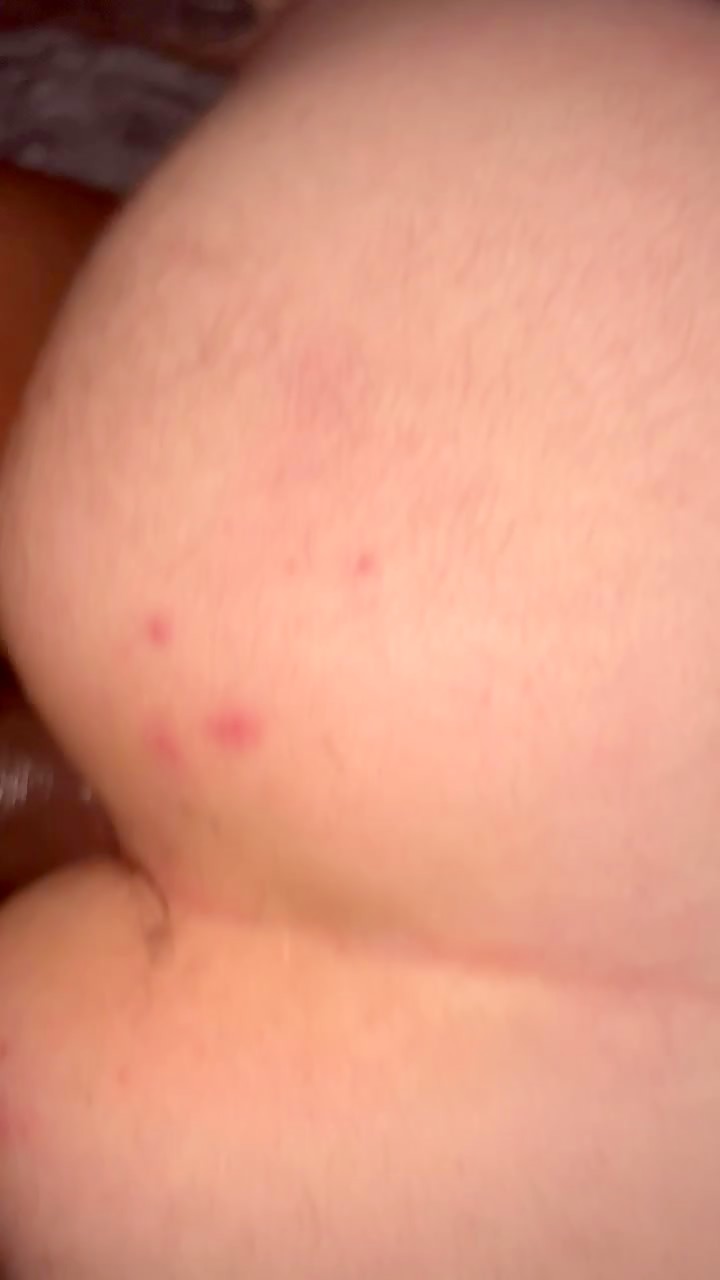 Thumb 12