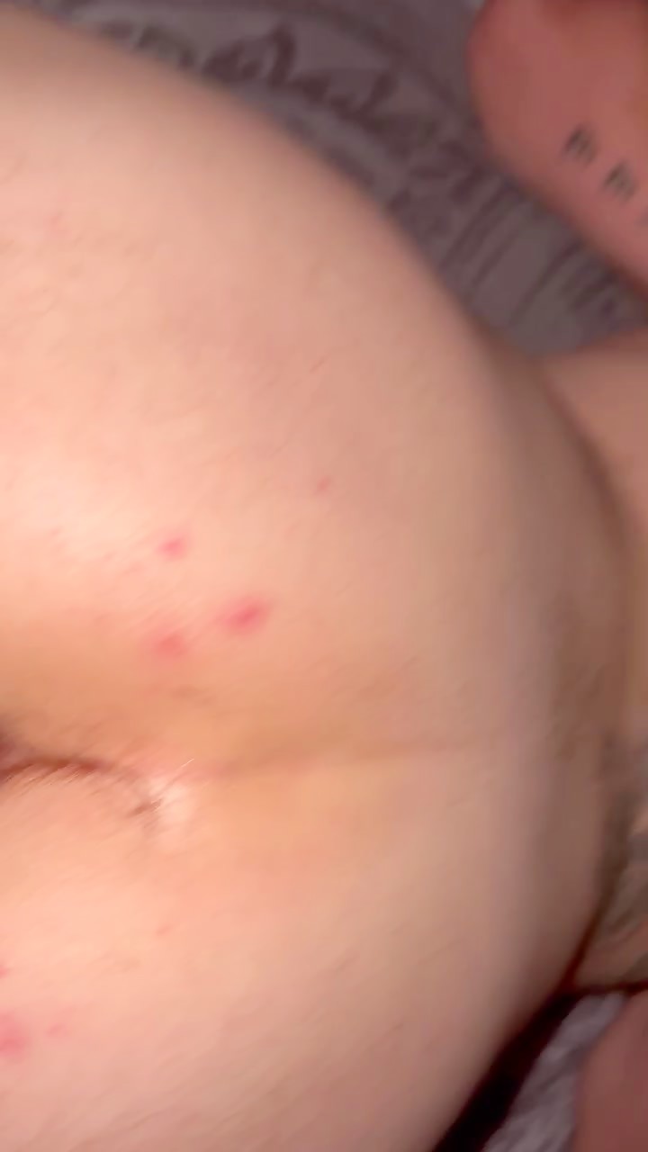 Thumb 8