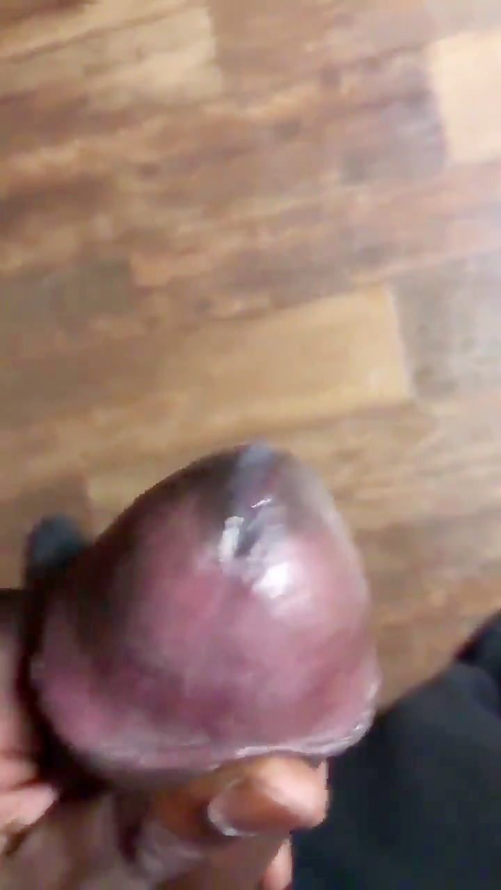Thumb 17