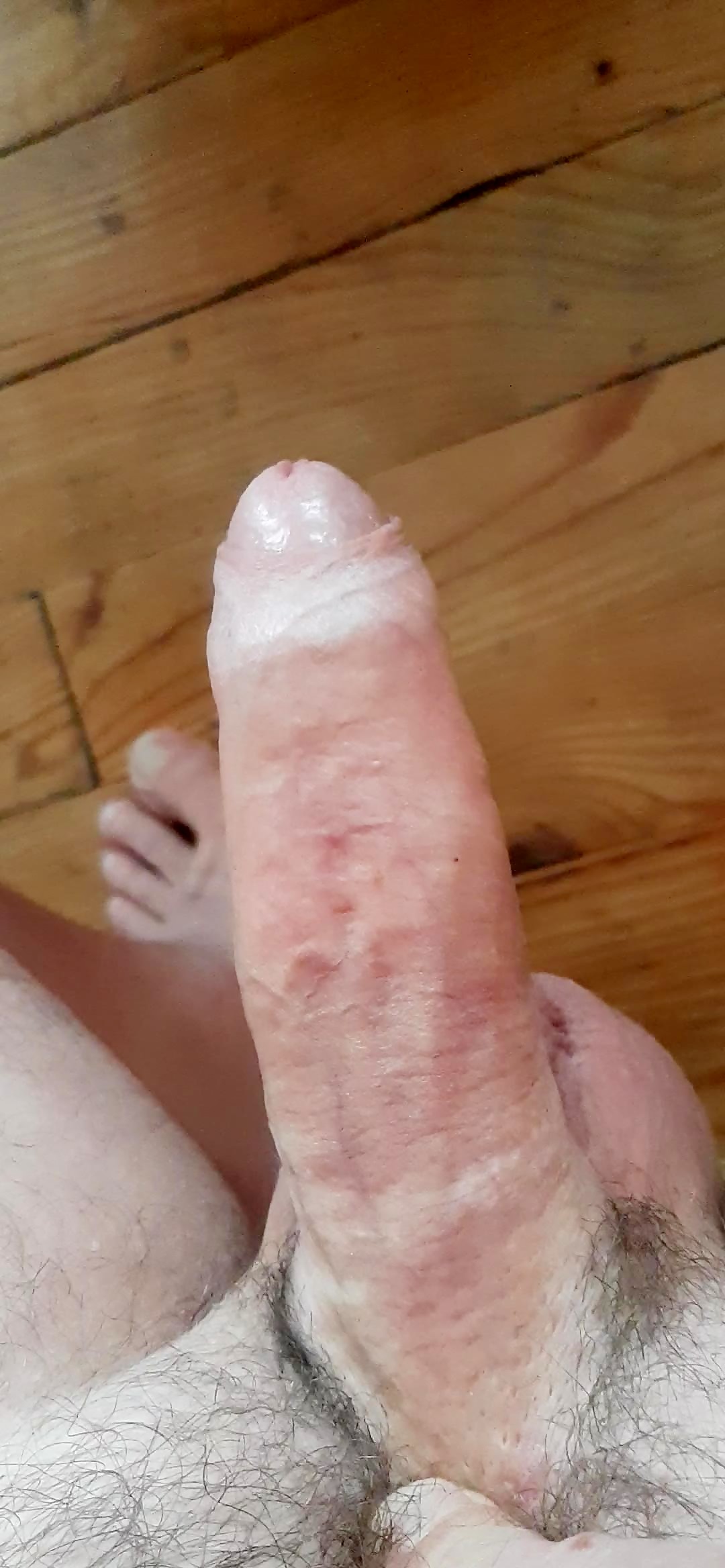 Thumb 11
