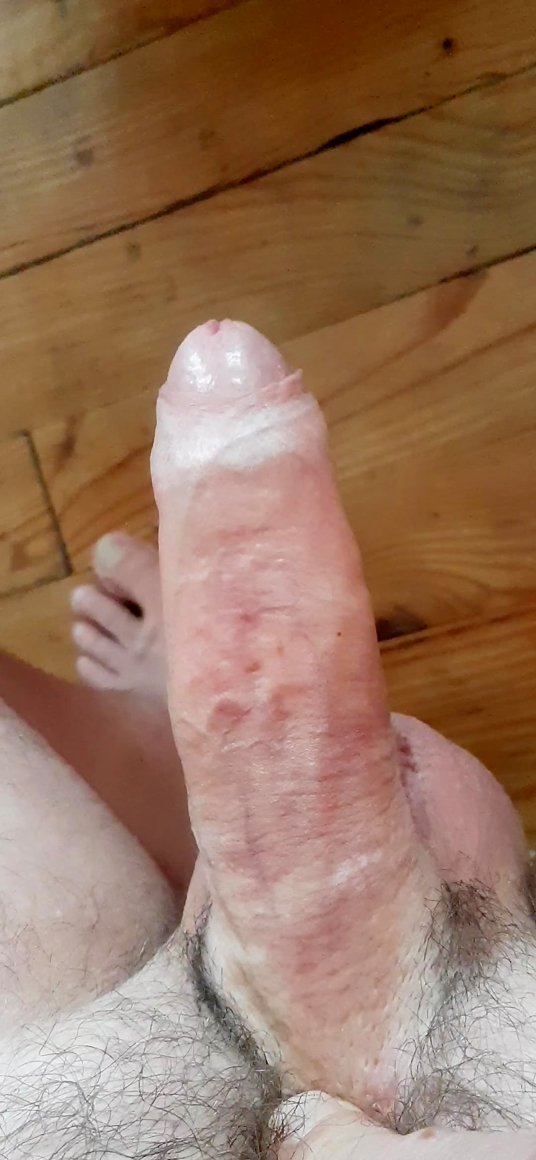 Thumb 12