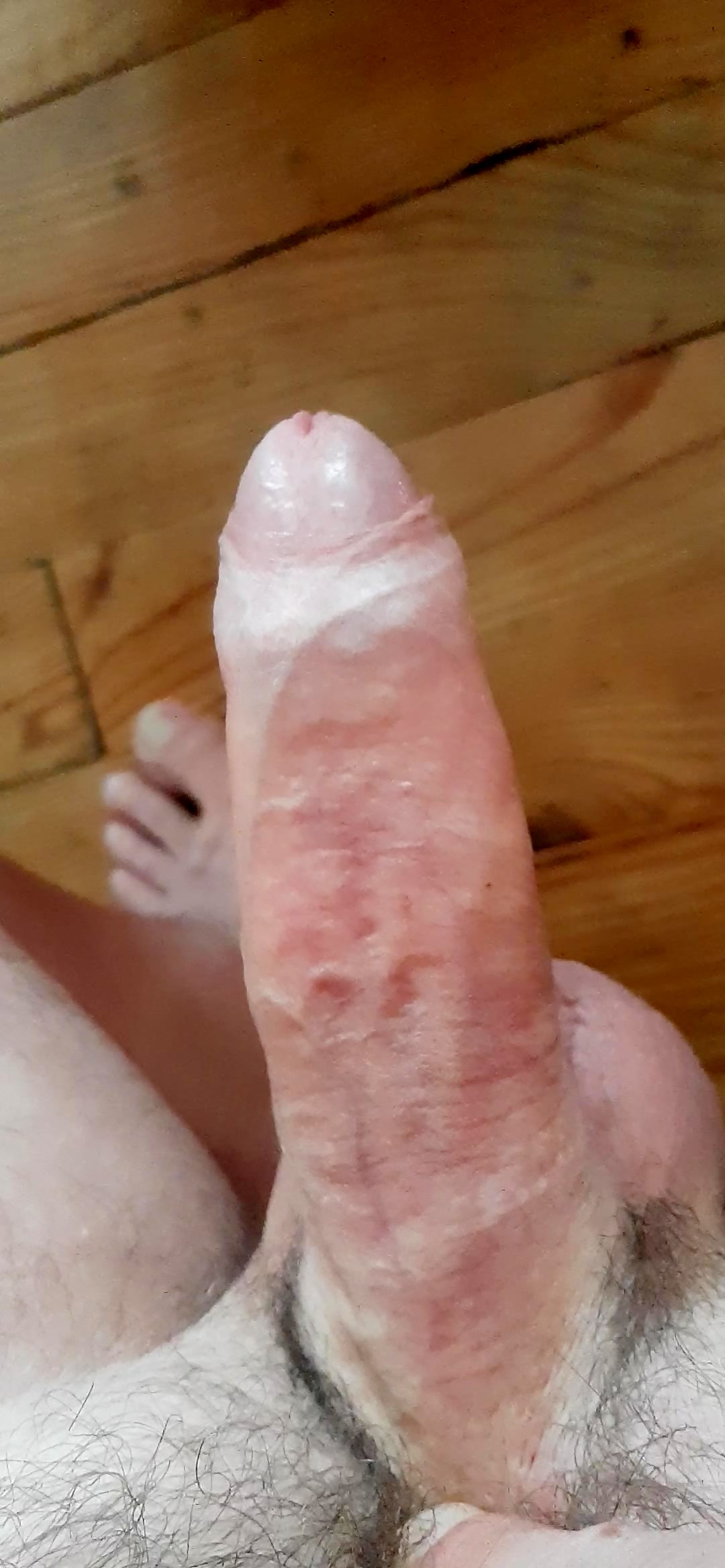 Thumb 14