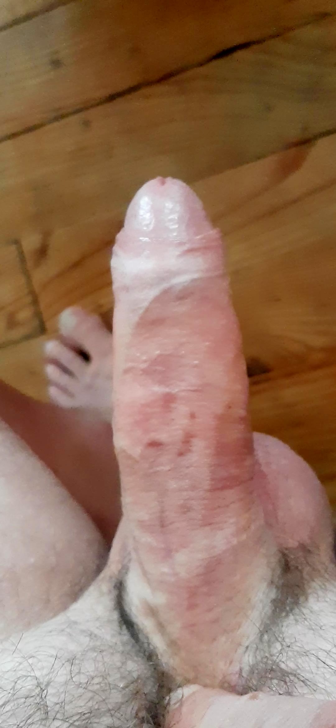 Thumb 19
