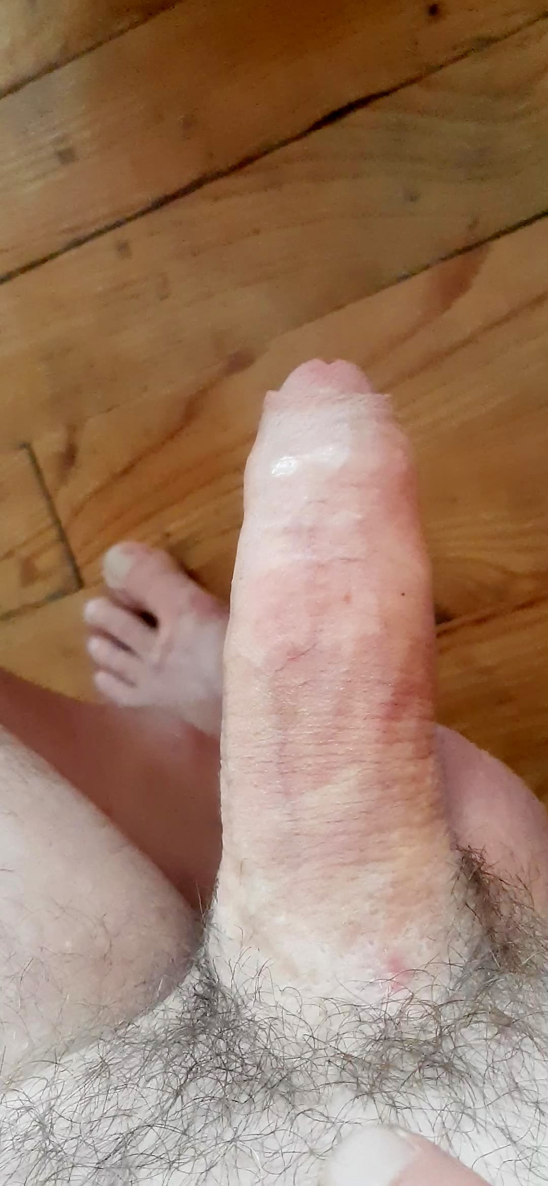 Thumb 6