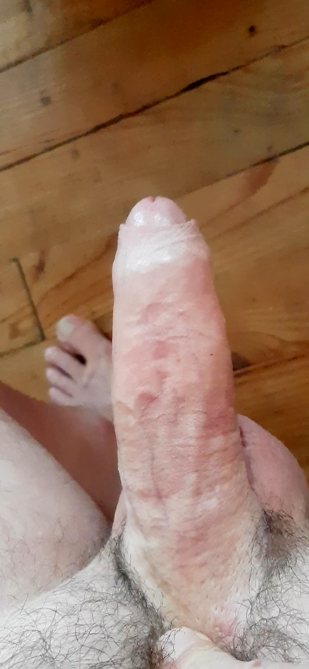 Thumb 9