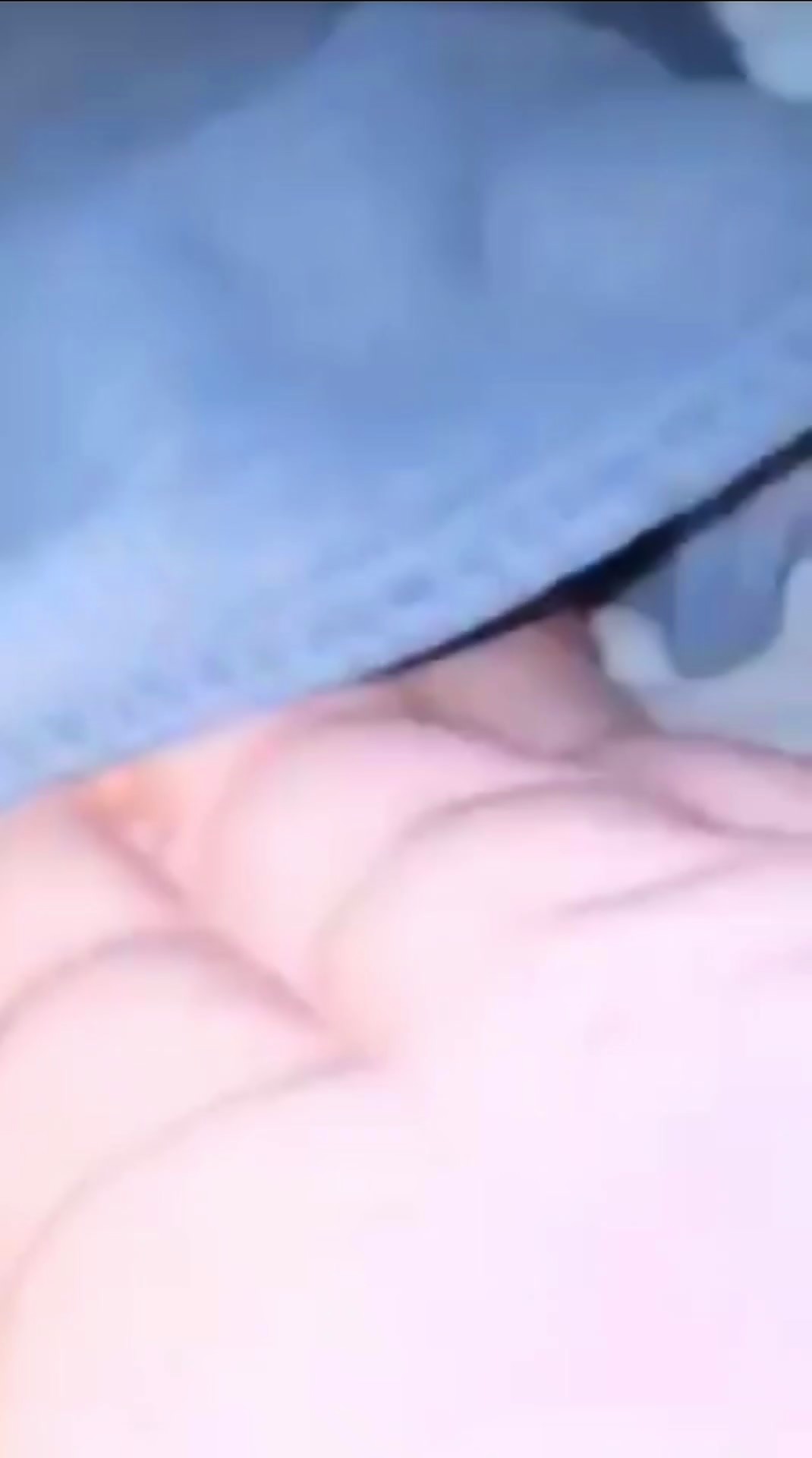 Thumb 17