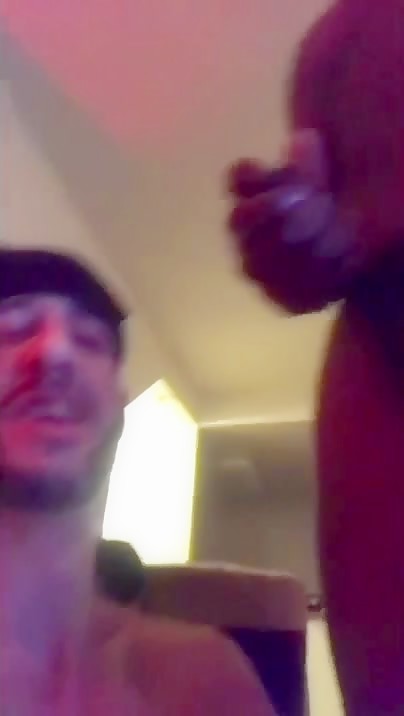 Thumb 17