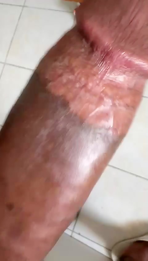 Thumb 10