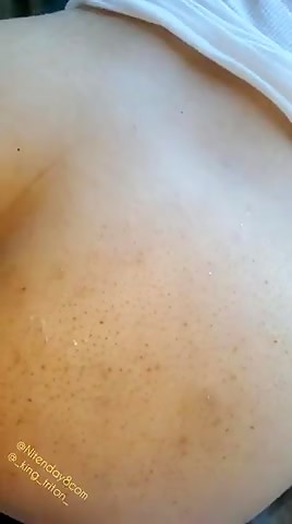 Thumb 16