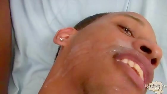 Thumb 20