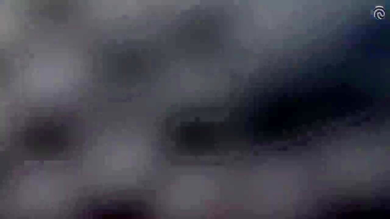Thumb 20